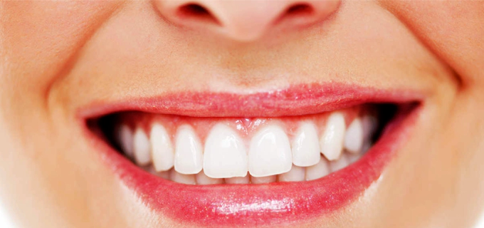 خدمات سفید کردن دندان ها